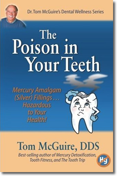 Amalgam Dental Fillings: The Poison in our Teeth